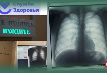 ОБ ИЗМЕНЕНИЯХ В РАБОТЕ ФЛЮОРОГРАФИЧЕСКИХ КАБИНЕТОВ